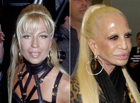 donatella versace avant apres|gianni versace logo.